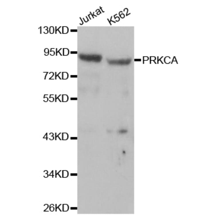 Western blot - PRKCA Antibody from Signalway Antibody (32053) - Antibodies.com