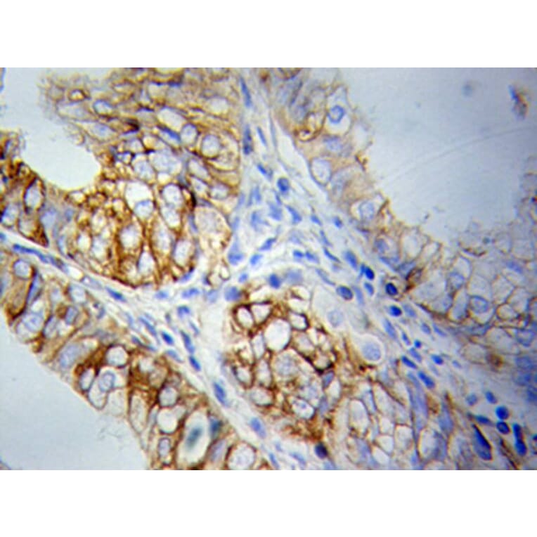 Immunohistochemistry - PRKCA Antibody from Signalway Antibody (32053) - Antibodies.com