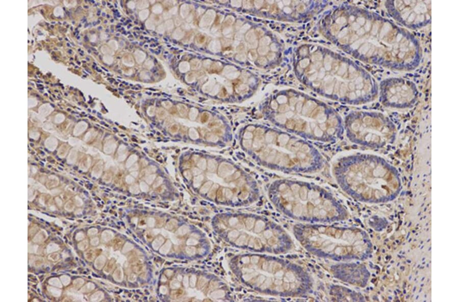 Immunohistochemistry - PRKCA Antibody from Signalway Antibody (32053) - Antibodies.com