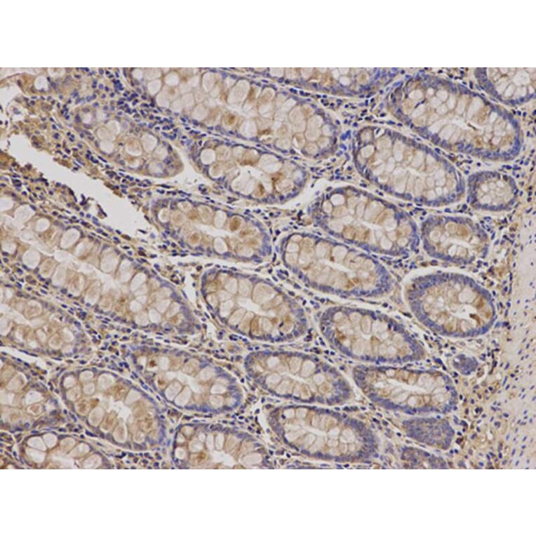 Immunohistochemistry - PRKCA Antibody from Signalway Antibody (32053) - Antibodies.com