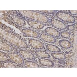 Immunohistochemistry - PRKCA Antibody from Signalway Antibody (32053) - Antibodies.com