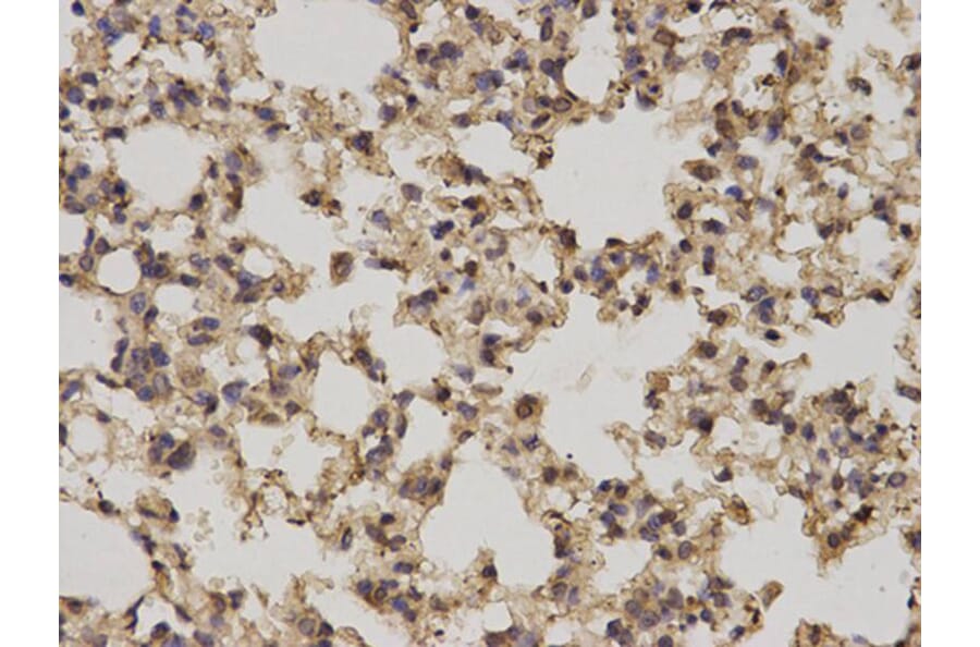 Immunohistochemistry - PRKCA Antibody from Signalway Antibody (32053) - Antibodies.com