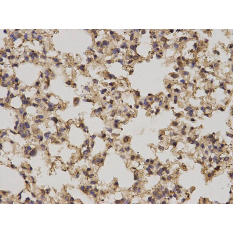 Immunohistochemistry - PRKCA Antibody from Signalway Antibody (32053) - Antibodies.com