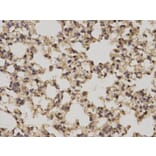 Immunohistochemistry - PRKCA Antibody from Signalway Antibody (32053) - Antibodies.com