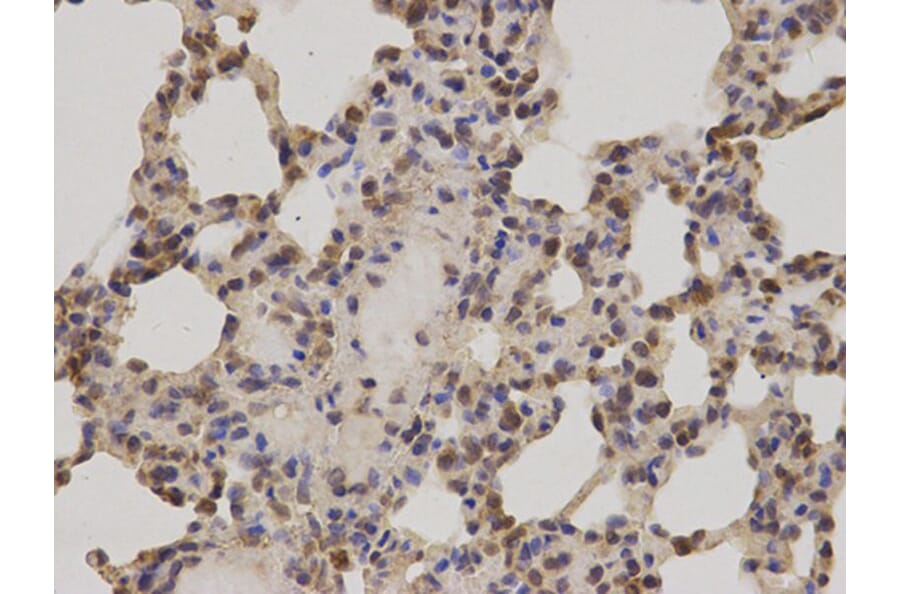 Immunohistochemistry - PRKCA Antibody from Signalway Antibody (32053) - Antibodies.com