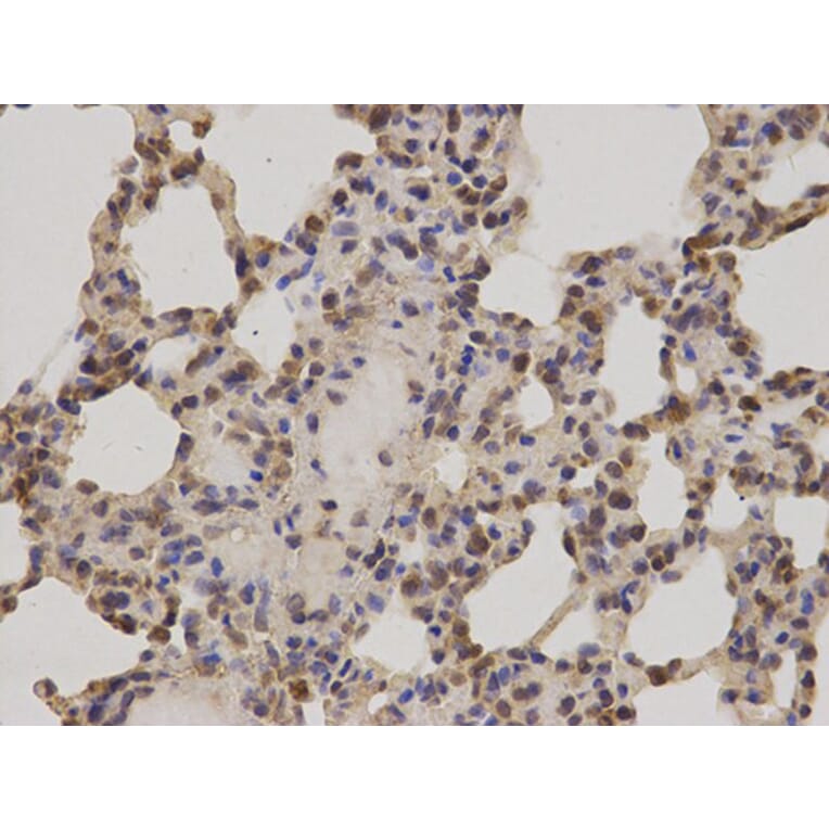 Immunohistochemistry - PRKCA Antibody from Signalway Antibody (32053) - Antibodies.com