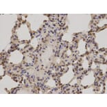 Immunohistochemistry - PRKCA Antibody from Signalway Antibody (32053) - Antibodies.com