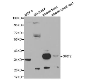 Western blot - SIRT2 Antibody from Signalway Antibody (32057) - Antibodies.com