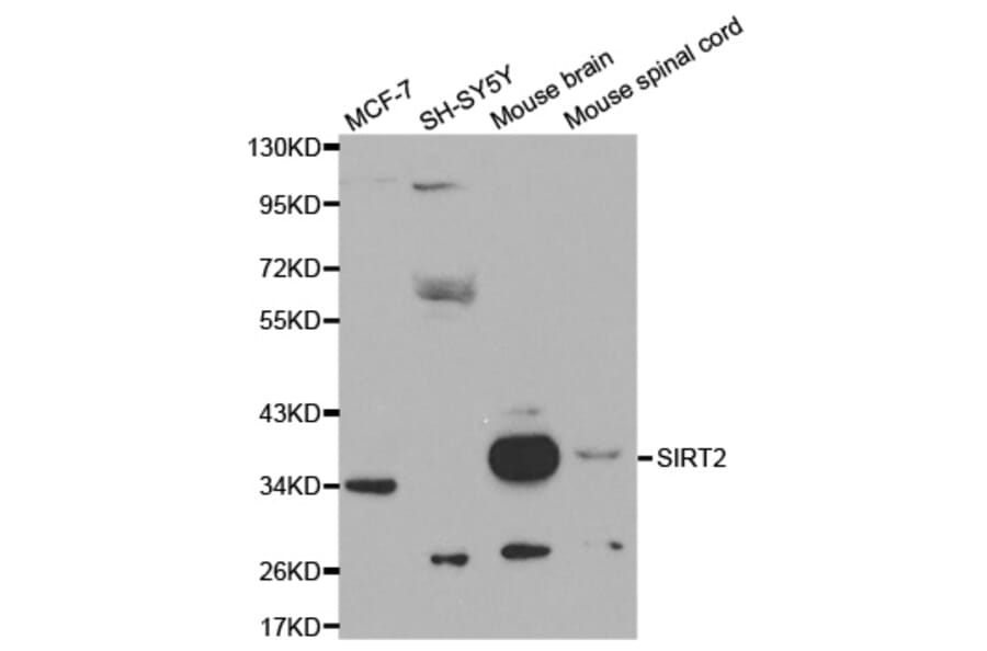 Western blot - SIRT2 Antibody from Signalway Antibody (32057) - Antibodies.com