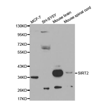 Western blot - SIRT2 Antibody from Signalway Antibody (32057) - Antibodies.com