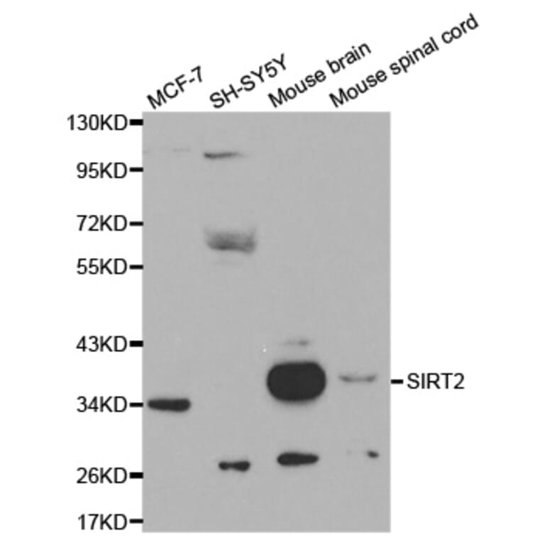 Western blot - SIRT2 Antibody from Signalway Antibody (32057) - Antibodies.com