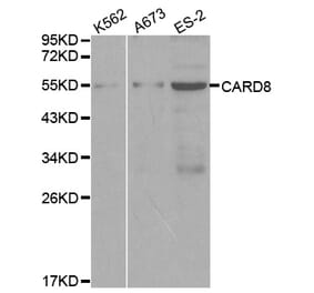 Western blot - CARD8 Antibody from Signalway Antibody (32067) - Antibodies.com