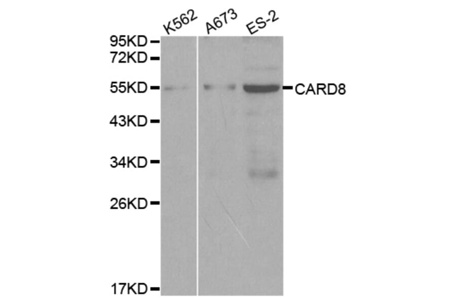 Western blot - CARD8 Antibody from Signalway Antibody (32067) - Antibodies.com