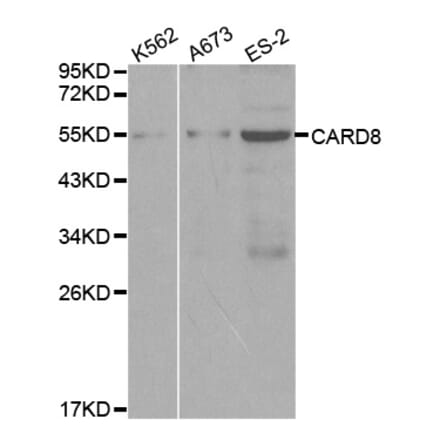 Western blot - CARD8 Antibody from Signalway Antibody (32067) - Antibodies.com