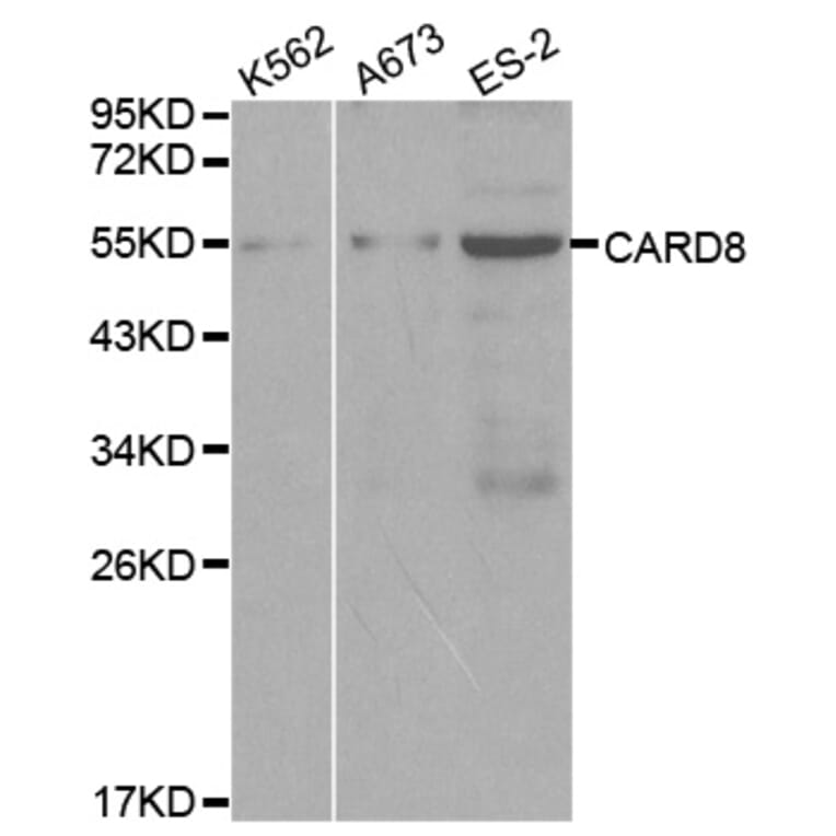 Western blot - CARD8 Antibody from Signalway Antibody (32067) - Antibodies.com
