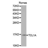 Western blot - TCL1A Antibody from Signalway Antibody (32079) - Antibodies.com