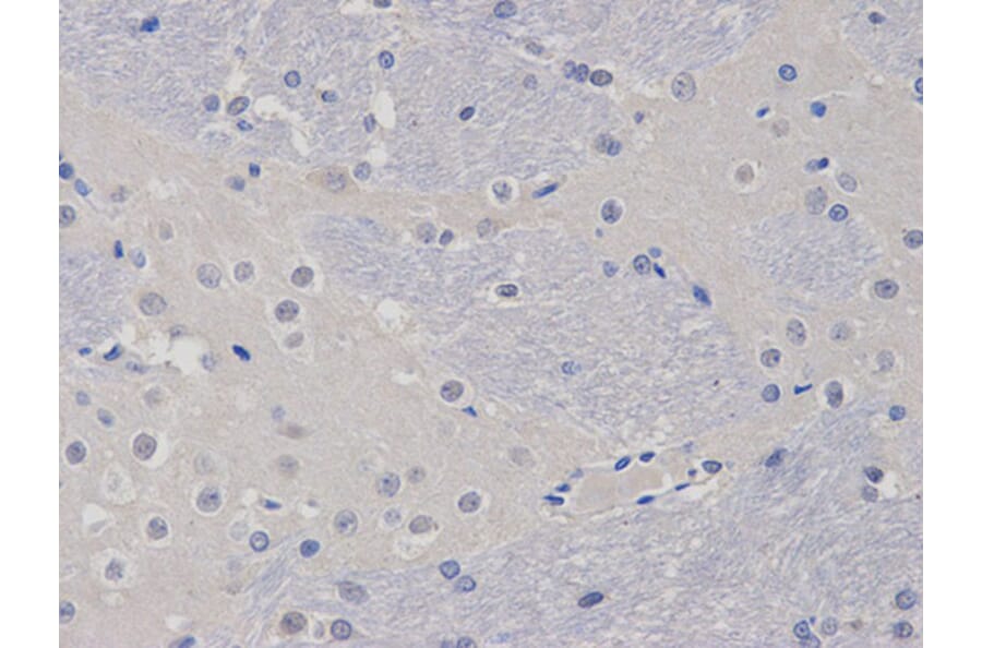 Immunohistochemistry - TCL1A Antibody from Signalway Antibody (32079) - Antibodies.com