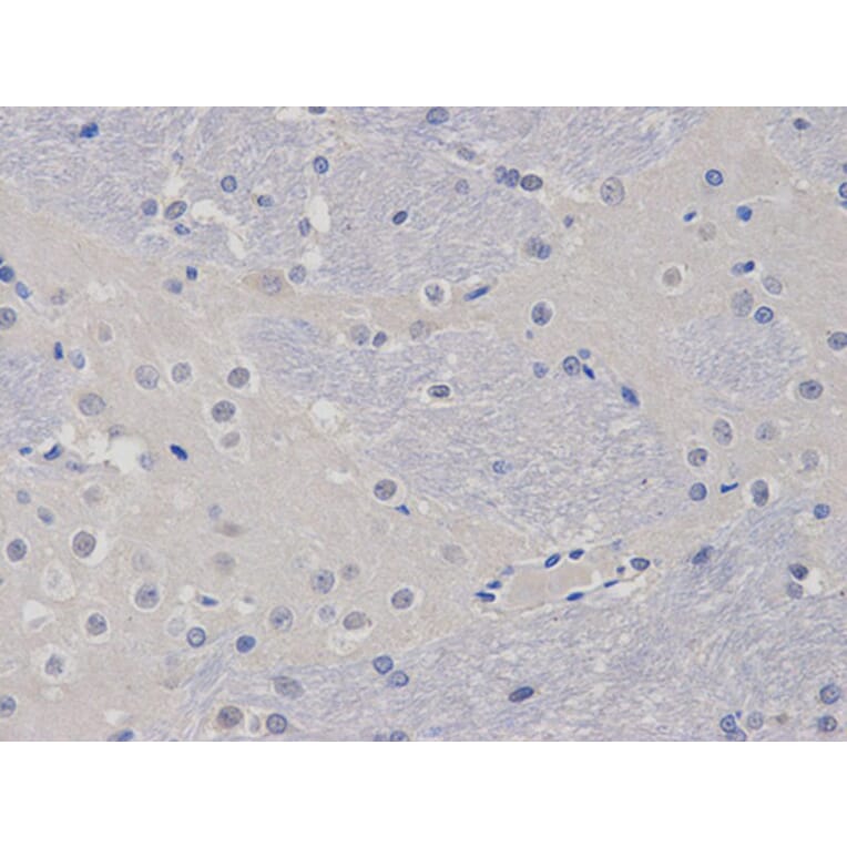 Immunohistochemistry - TCL1A Antibody from Signalway Antibody (32079) - Antibodies.com