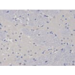 Immunohistochemistry - TCL1A Antibody from Signalway Antibody (32079) - Antibodies.com