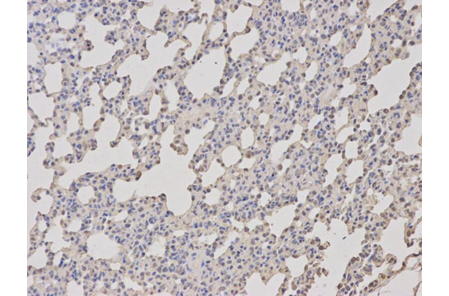 Immunohistochemistry - TCL1A Antibody from Signalway Antibody (32079) - Antibodies.com