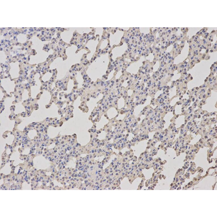 Immunohistochemistry - TCL1A Antibody from Signalway Antibody (32079) - Antibodies.com