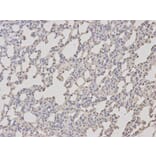 Immunohistochemistry - TCL1A Antibody from Signalway Antibody (32079) - Antibodies.com