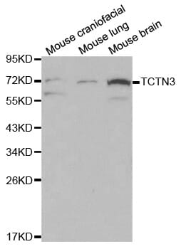 Western blot analysis of various cell lines using TCTN3 antibody.