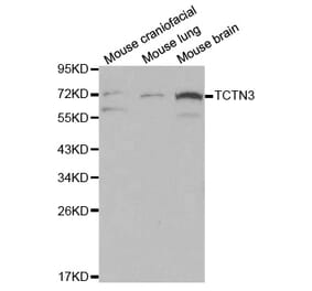 Western blot - TCTN3 Antibody from Signalway Antibody (32081) - Antibodies.com
