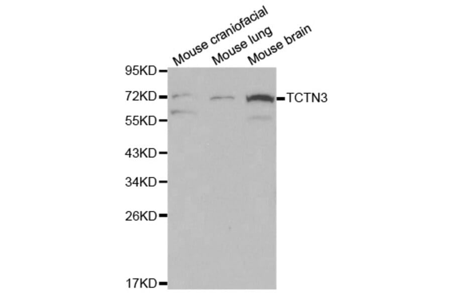 Western blot - TCTN3 Antibody from Signalway Antibody (32081) - Antibodies.com