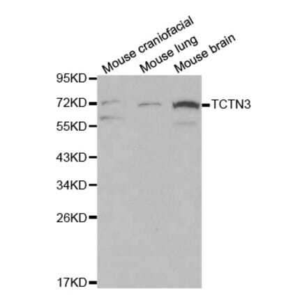Western blot - TCTN3 Antibody from Signalway Antibody (32081) - Antibodies.com