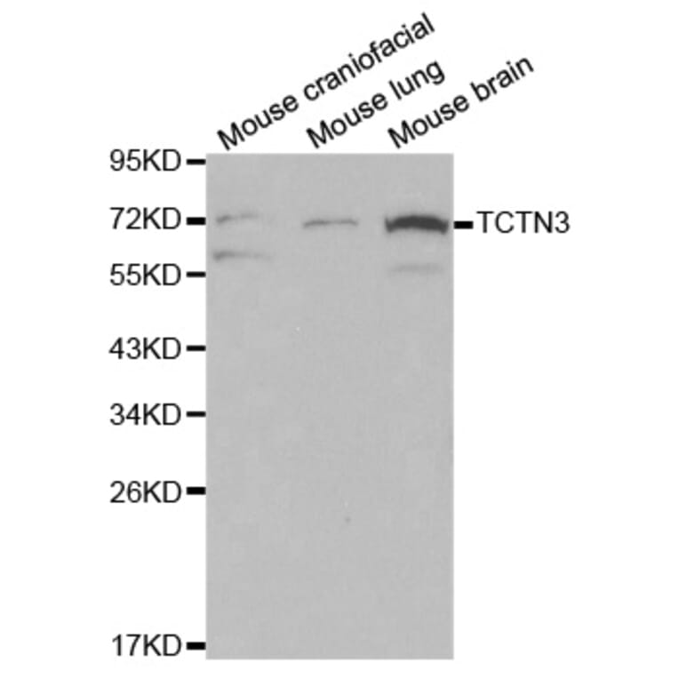 Western blot - TCTN3 Antibody from Signalway Antibody (32081) - Antibodies.com