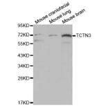 Western blot - TCTN3 Antibody from Signalway Antibody (32081) - Antibodies.com
