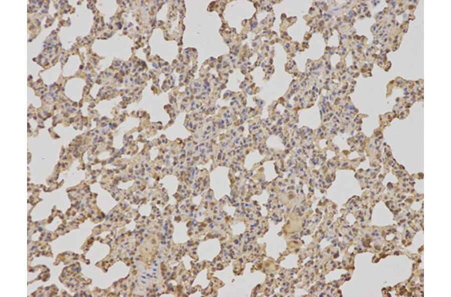 Immunohistochemistry - TCTN3 Antibody from Signalway Antibody (32081) - Antibodies.com