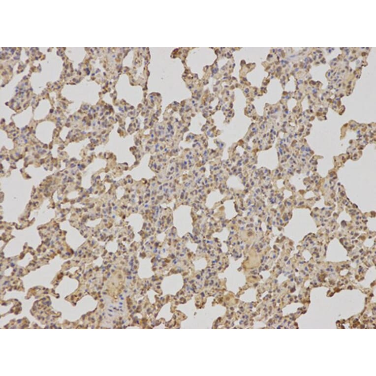 Immunohistochemistry - TCTN3 Antibody from Signalway Antibody (32081) - Antibodies.com
