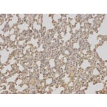 Immunohistochemistry - TCTN3 Antibody from Signalway Antibody (32081) - Antibodies.com