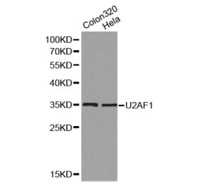 Western blot - U2AF1 Antibody from Signalway Antibody (32131) - Antibodies.com