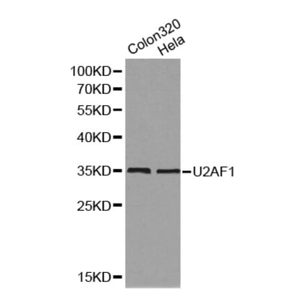 Western blot - U2AF1 Antibody from Signalway Antibody (32131) - Antibodies.com