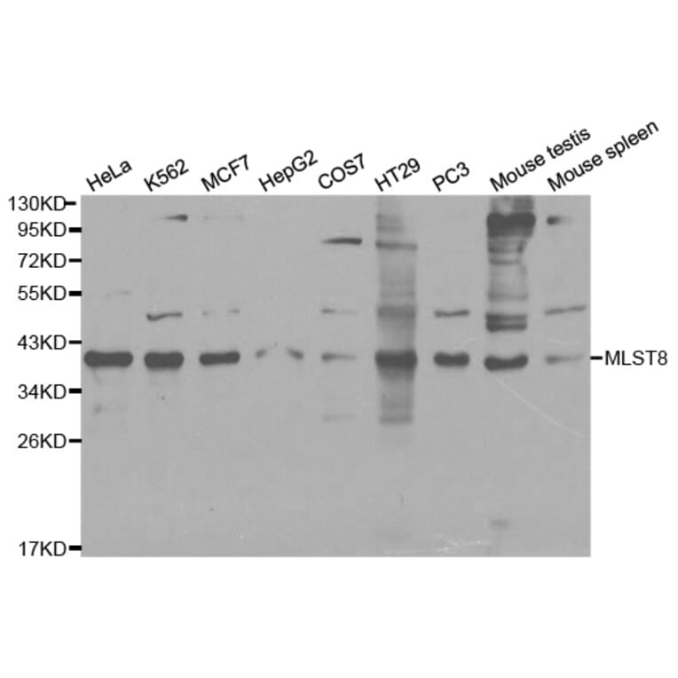 Western blot - MLST8 Antibody from Signalway Antibody (32136) - Antibodies.com
