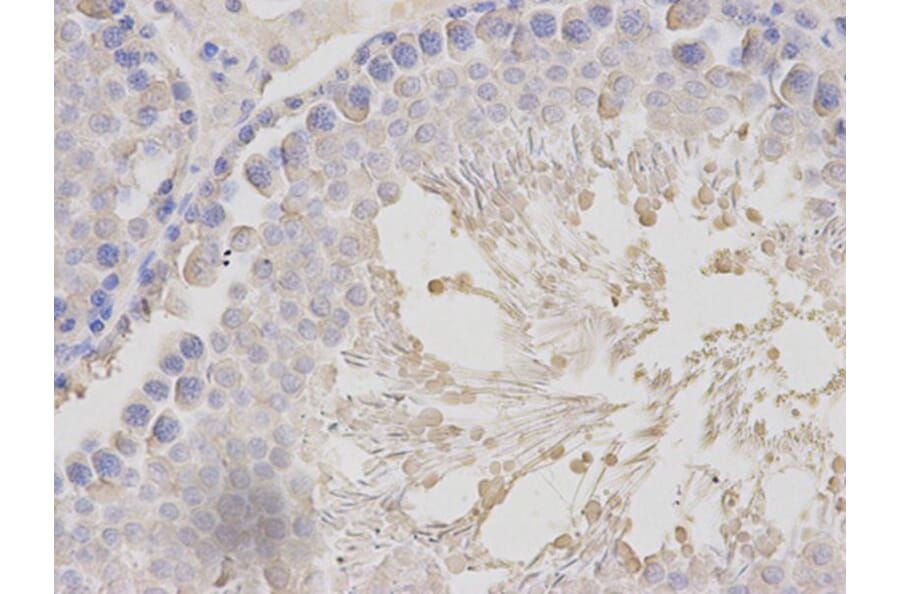 Immunohistochemistry - MLST8 Antibody from Signalway Antibody (32136) - Antibodies.com