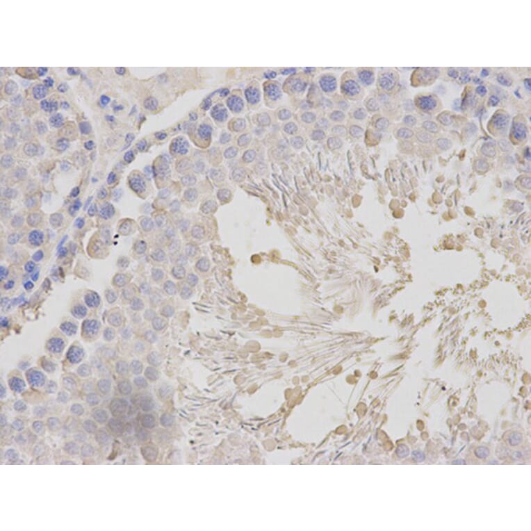 Immunohistochemistry - MLST8 Antibody from Signalway Antibody (32136) - Antibodies.com