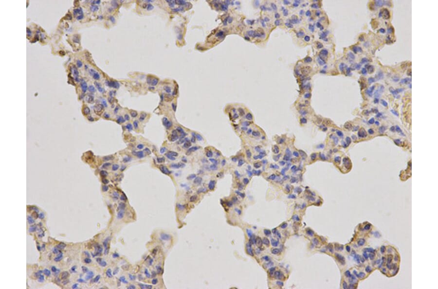 Immunohistochemistry - MLST8 Antibody from Signalway Antibody (32136) - Antibodies.com