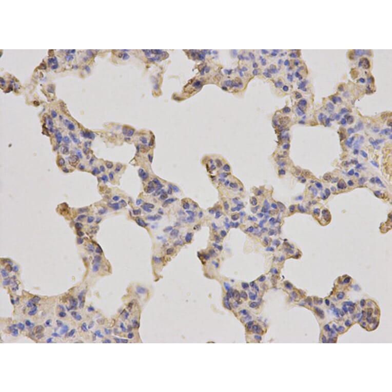 Immunohistochemistry - MLST8 Antibody from Signalway Antibody (32136) - Antibodies.com