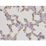 Immunohistochemistry - MLST8 Antibody from Signalway Antibody (32136) - Antibodies.com