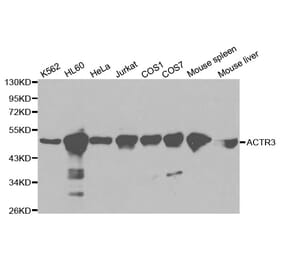 Western blot - ACTR3 Antibody from Signalway Antibody (32140) - Antibodies.com