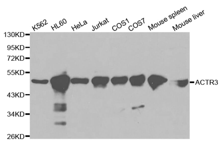 Western blot - ACTR3 Antibody from Signalway Antibody (32140) - Antibodies.com