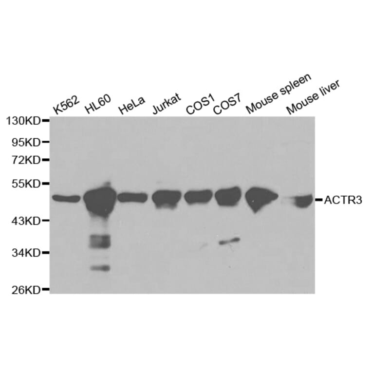 Western blot - ACTR3 Antibody from Signalway Antibody (32140) - Antibodies.com