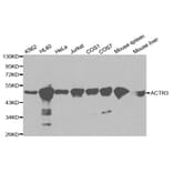 Western blot - ACTR3 Antibody from Signalway Antibody (32140) - Antibodies.com