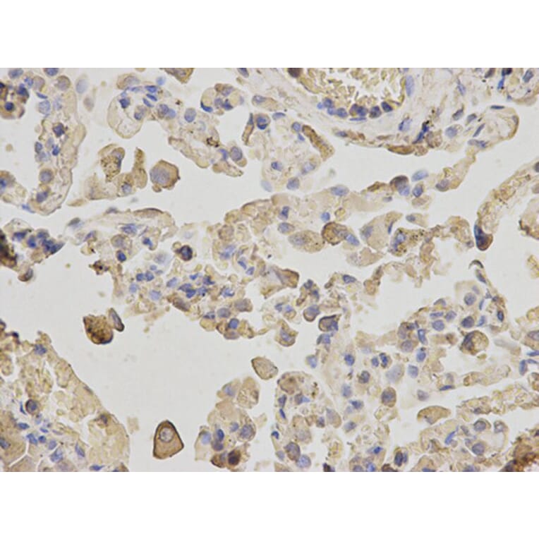 Immunohistochemistry - ACTR3 Antibody from Signalway Antibody (32140) - Antibodies.com