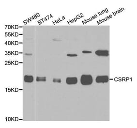 Western blot - CSRP1 Antibody from Signalway Antibody (32145) - Antibodies.com