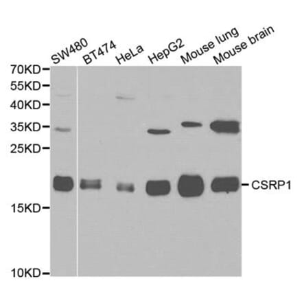 Western blot - CSRP1 Antibody from Signalway Antibody (32145) - Antibodies.com